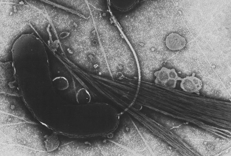 Il vibrione del colera visto al microscopio